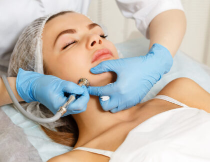 microdermabrasion