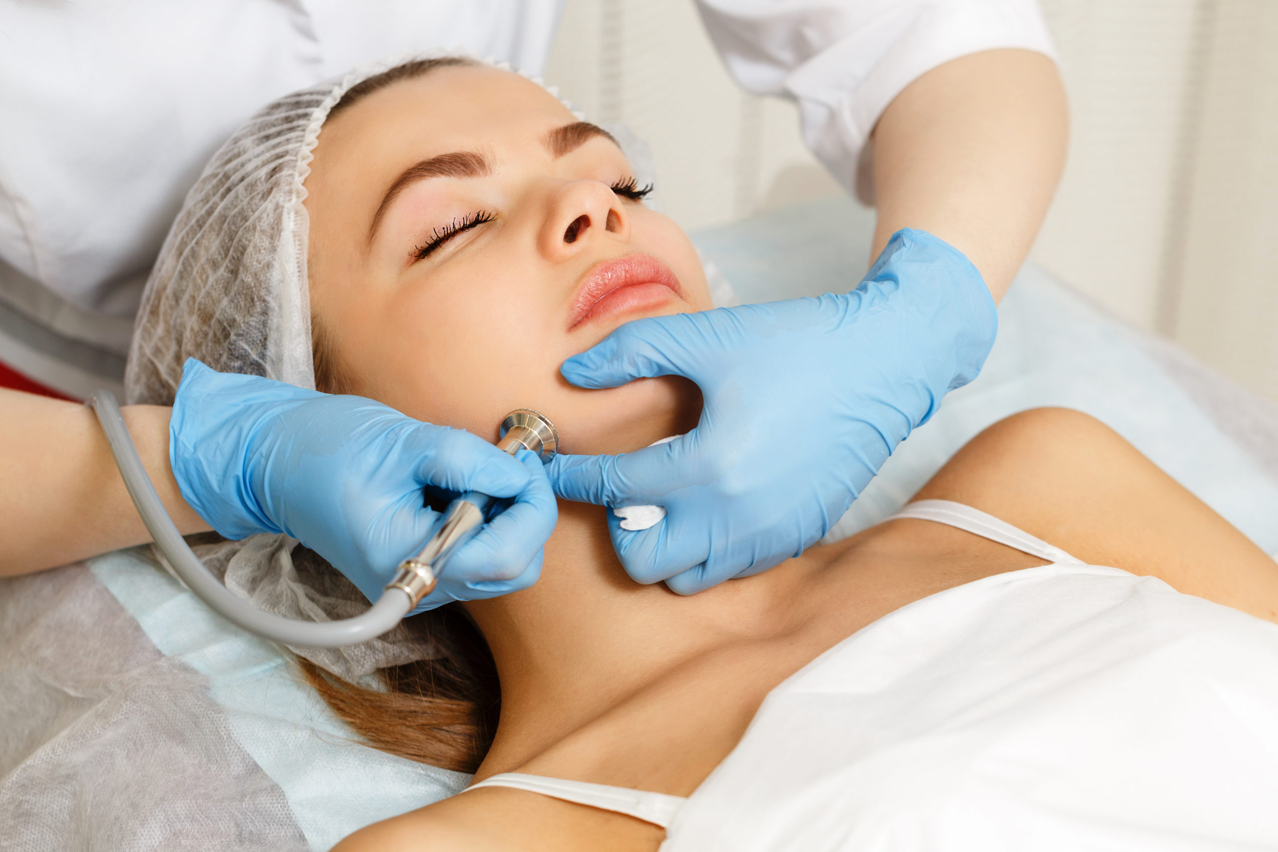 microdermabrasion