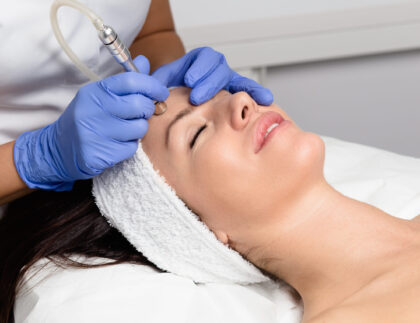 Microdermabrasion