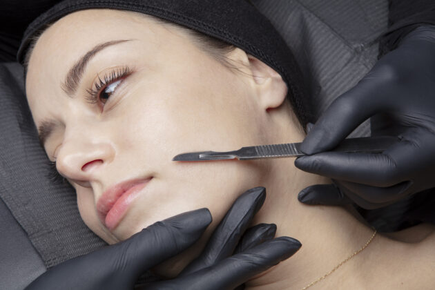 Dermaplaning Annandale VA