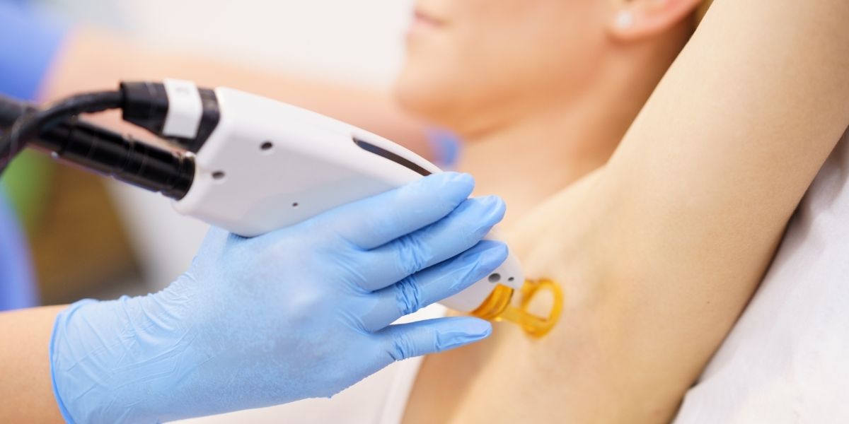 laser hair removal in Annandale, VA