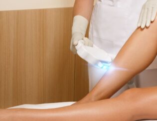 laser hair removal in Annandale, VA