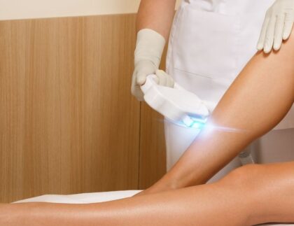 laser hair removal in Annandale, VA